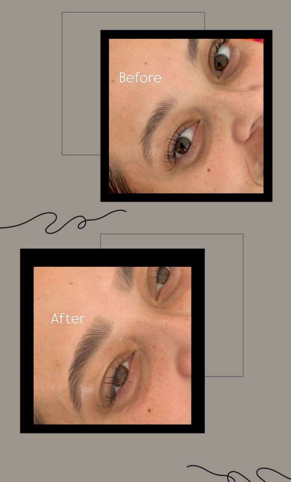 Before & after